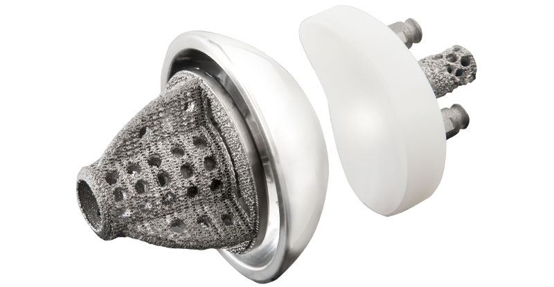 Equinoxe Stemless Shoulder