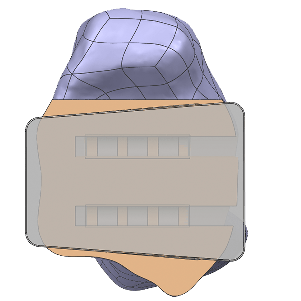 Diseño Histórico de Prótesis de Tobillo