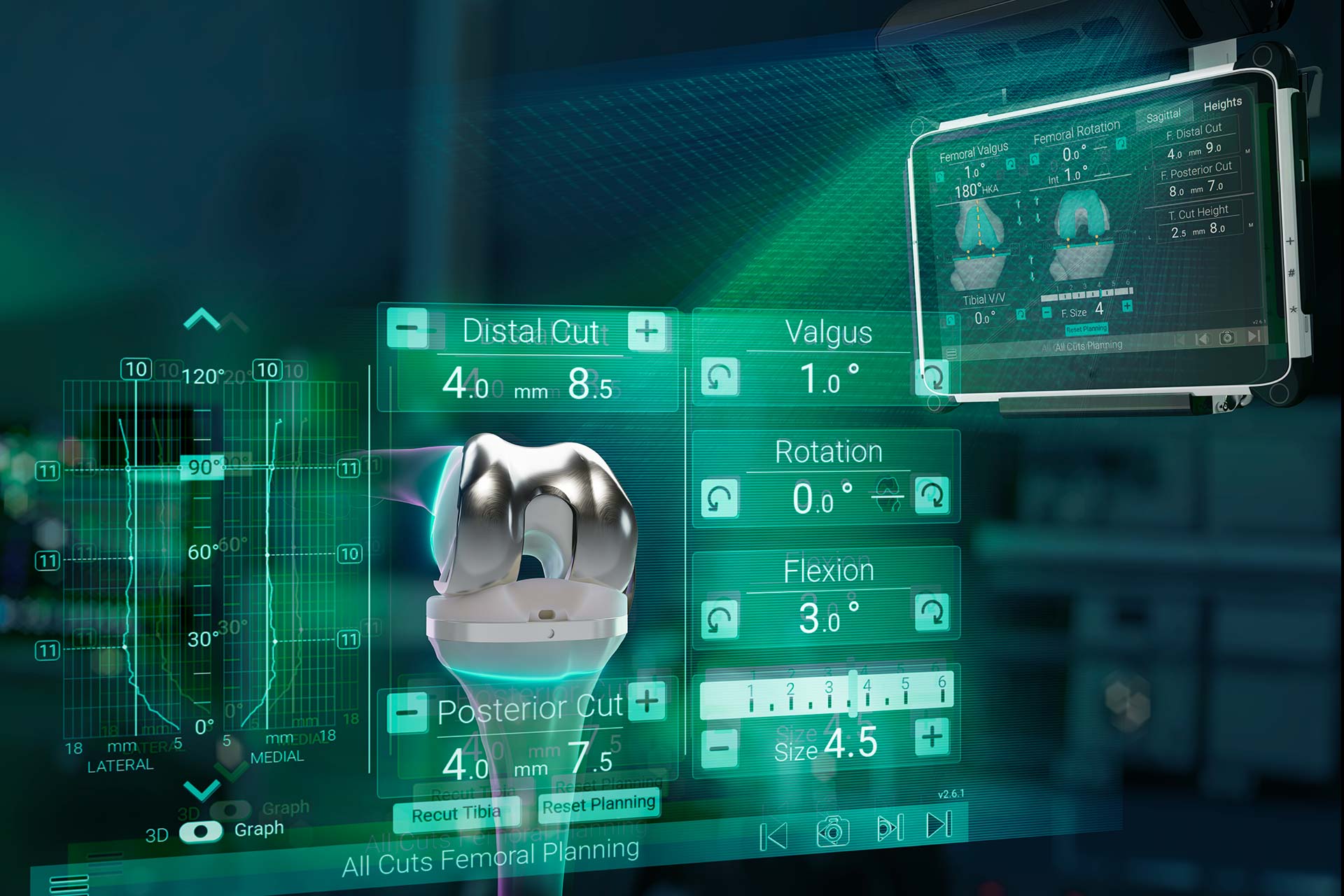 Advita Ortho GPS Knee with Newton