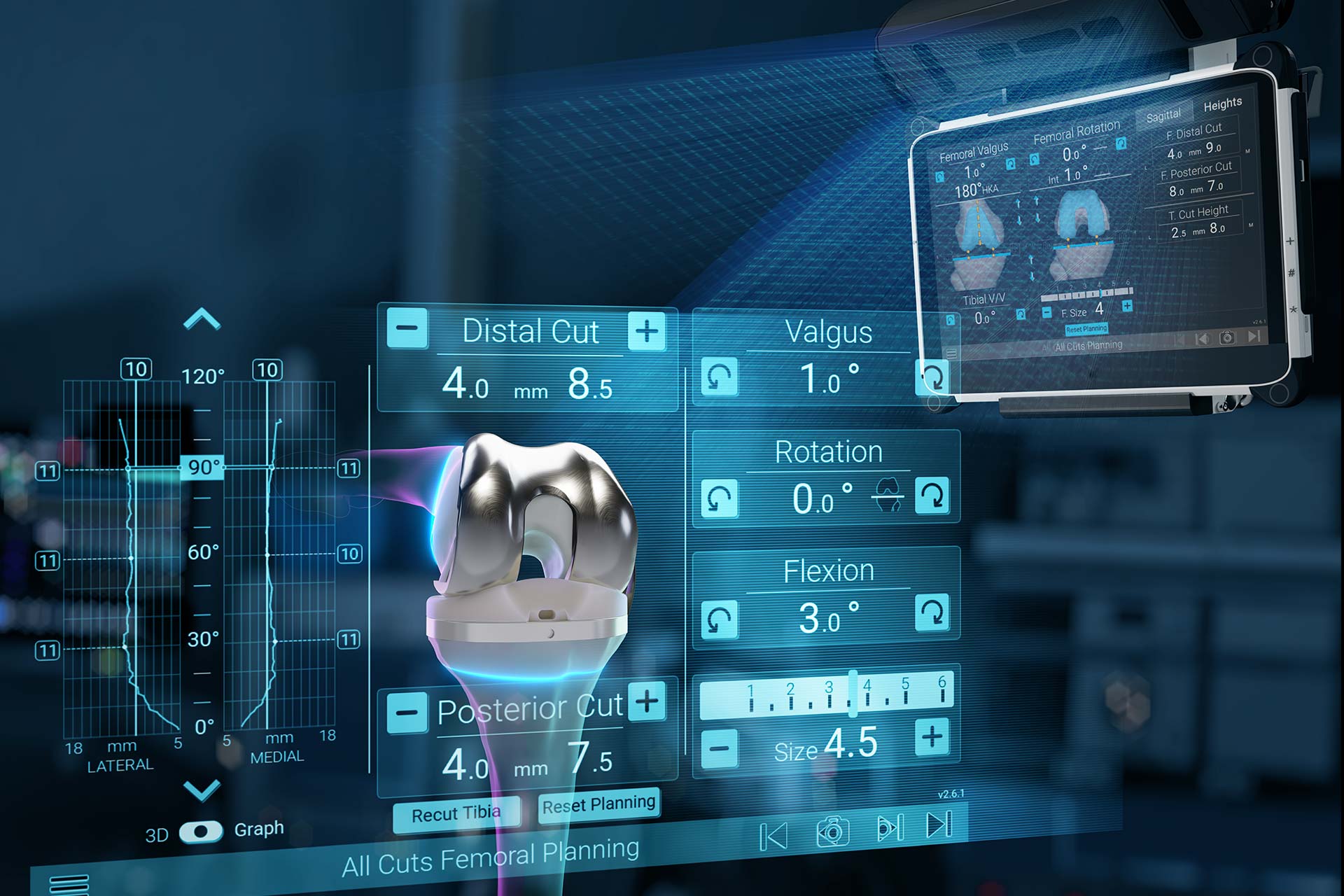 Advita Ortho GPS Knee with Newton