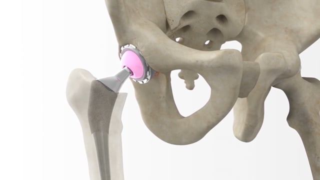 vimeo placeholder image